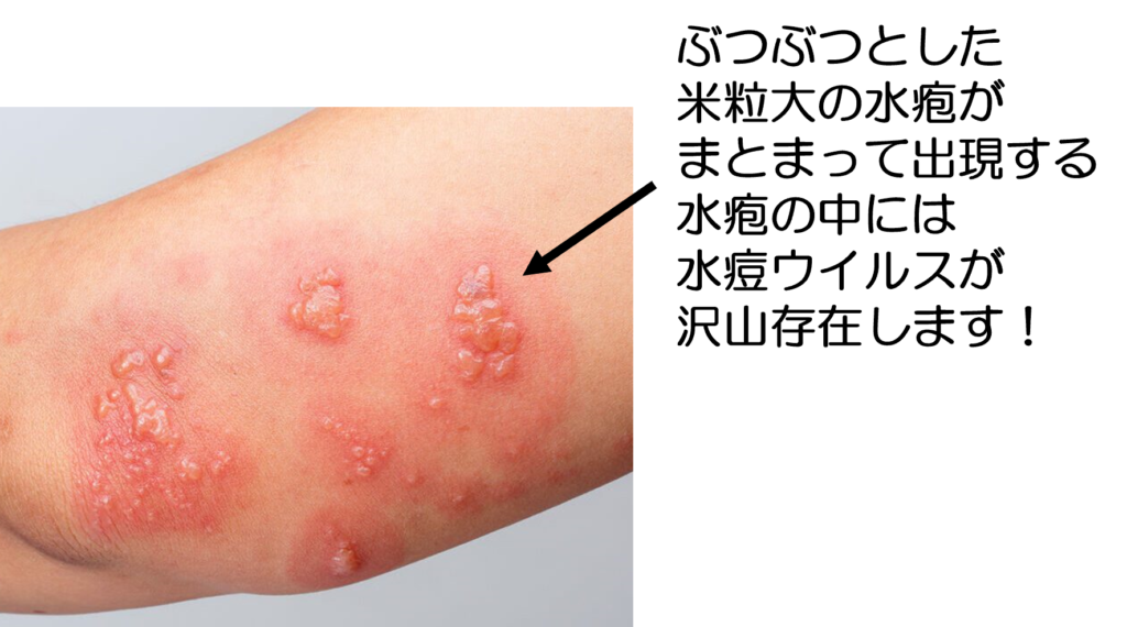 発疹はどのようにして発生しますか?